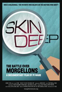 دانلود مستند Skin Deep: The Battle Over Morgellons 2019104233-746343845